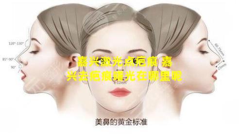 嘉兴激光点疤痕 嘉兴去疤痕曙光在哪里呢